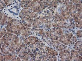 DSTN Antibody in Immunohistochemistry (Paraffin) (IHC (P))