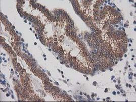 DSTN Antibody in Immunohistochemistry (Paraffin) (IHC (P))