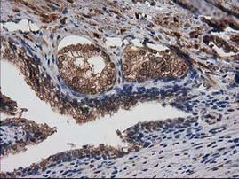 DSTN Antibody in Immunohistochemistry (Paraffin) (IHC (P))