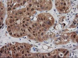 DSTN Antibody in Immunohistochemistry (Paraffin) (IHC (P))