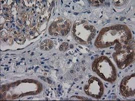 DSTN Antibody in Immunohistochemistry (Paraffin) (IHC (P))