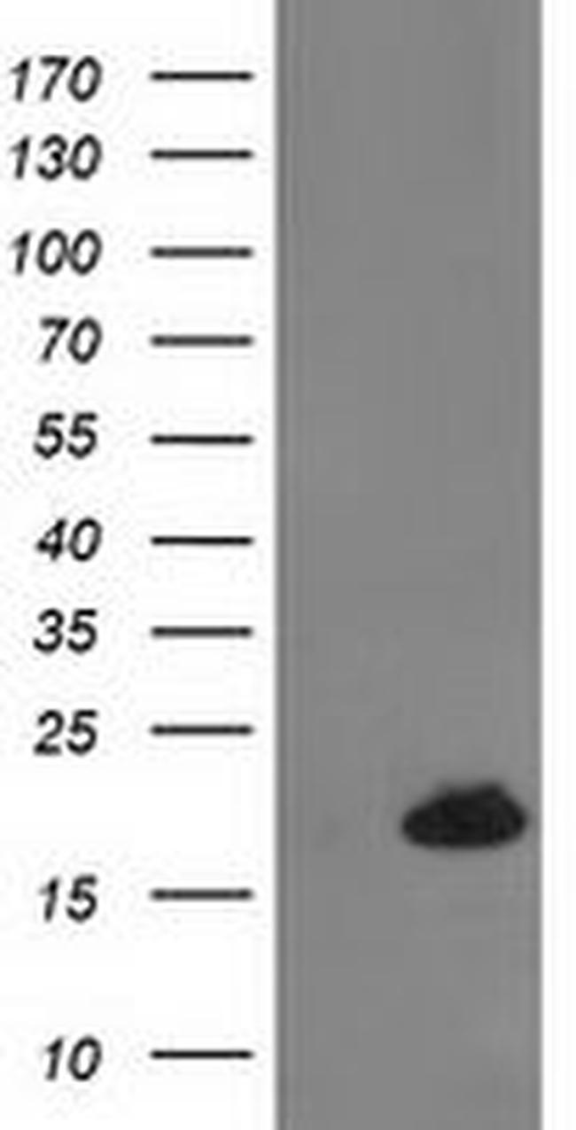 DSTN Antibody in Western Blot (WB)