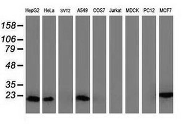 DSTN Antibody in Western Blot (WB)