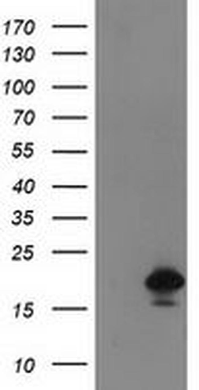 DSTN Antibody in Western Blot (WB)