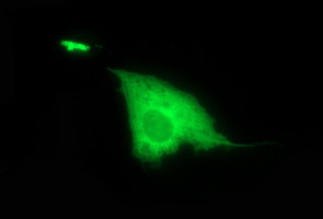 DTD1 Antibody in Immunocytochemistry (ICC/IF)