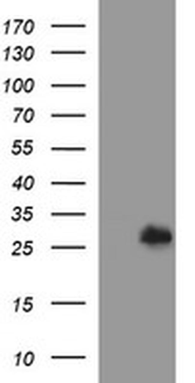 DTD1 Antibody in Western Blot (WB)