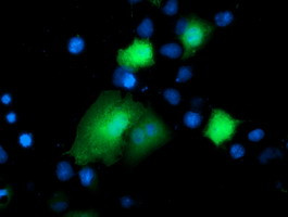 DTYMK Antibody in Immunocytochemistry (ICC/IF)