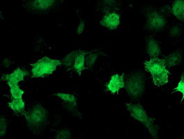 DTYMK Antibody in Immunocytochemistry (ICC/IF)