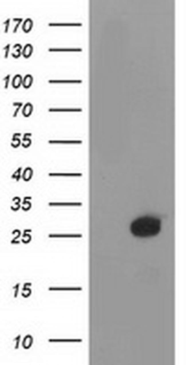 DTYMK Antibody in Western Blot (WB)