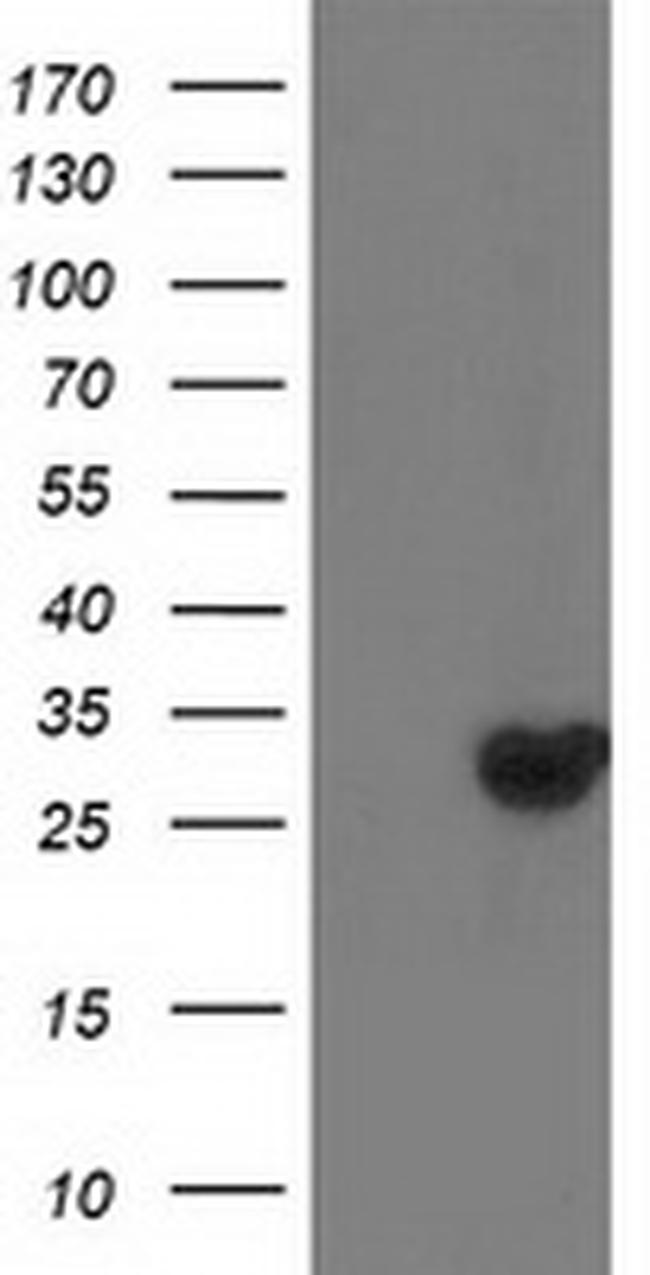 DTYMK Antibody in Western Blot (WB)