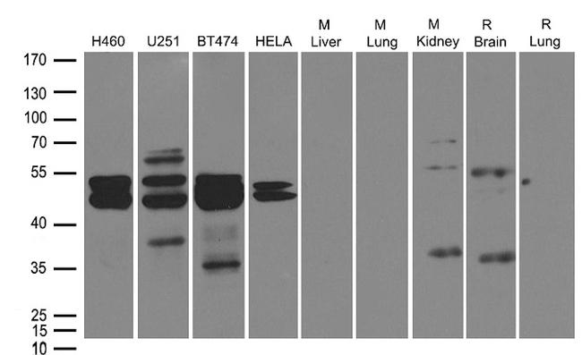 DUSP1 Antibody in Western Blot (WB)