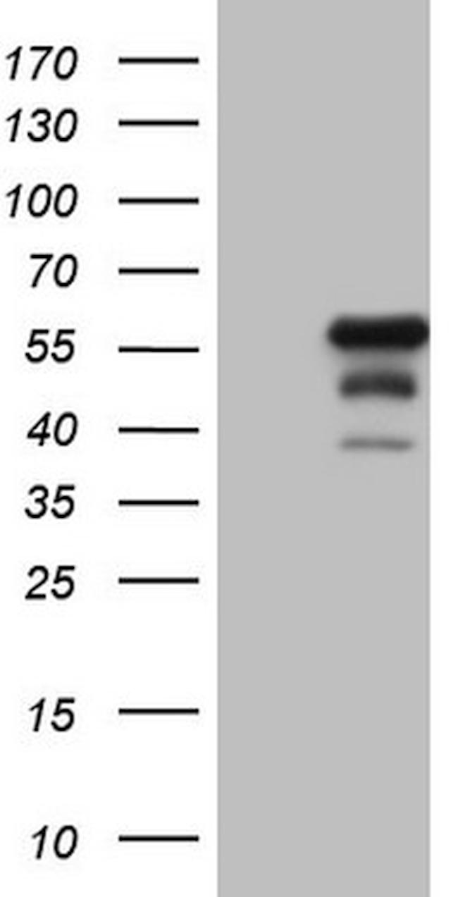 DUSP10 Antibody in Western Blot (WB)