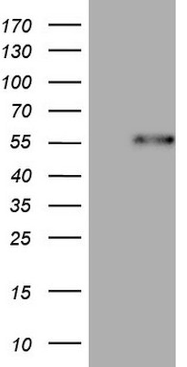 DUSP10 Antibody in Western Blot (WB)