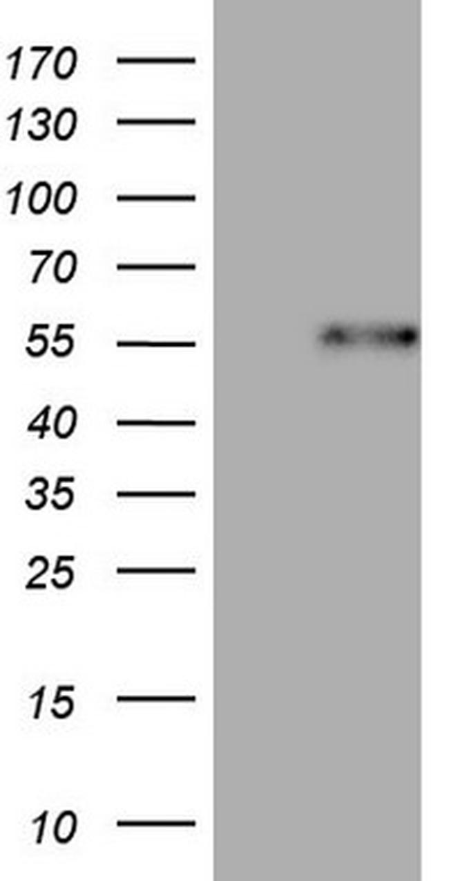 DUSP10 Antibody in Western Blot (WB)