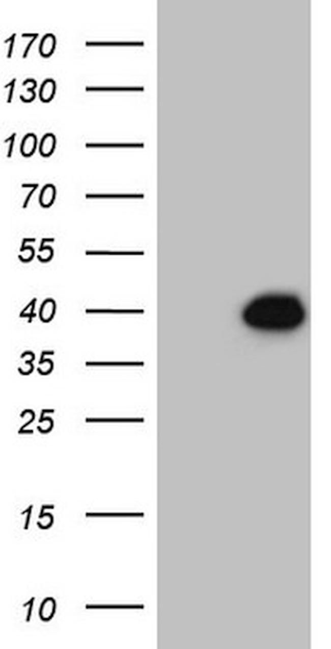 DUSP4 Antibody in Western Blot (WB)