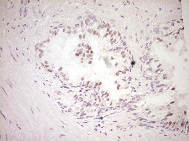 DVL2 Antibody in Immunohistochemistry (Paraffin) (IHC (P))