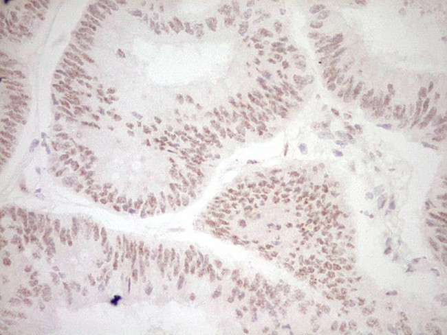 DVL2 Antibody in Immunohistochemistry (Paraffin) (IHC (P))