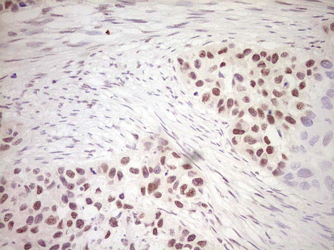 DVL2 Antibody in Immunohistochemistry (Paraffin) (IHC (P))