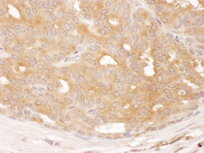 DYNC1LI1 Antibody in Immunohistochemistry (IHC)