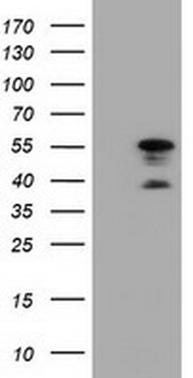 DYNC1LI1 Antibody in Western Blot (WB)