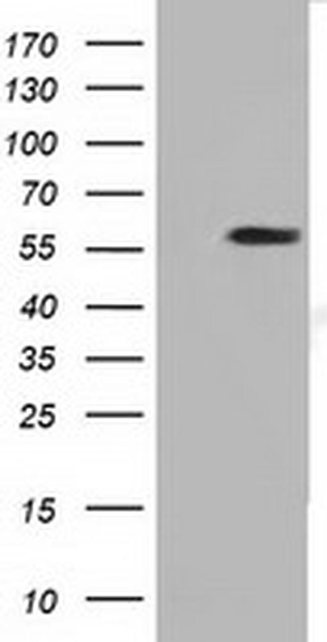 DYNC1LI1 Antibody in Western Blot (WB)