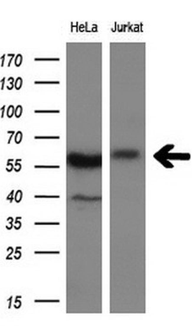 DYNC1LI1 Antibody in Western Blot (WB)