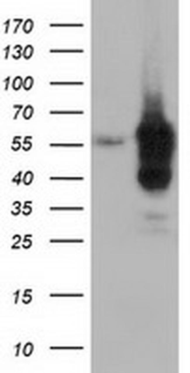 DYNC1LI1 Antibody in Western Blot (WB)