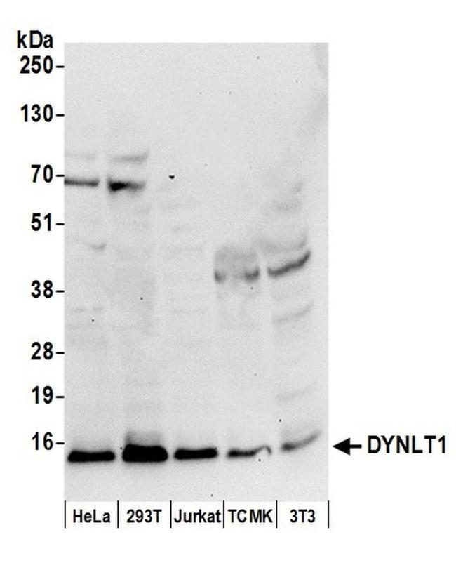 DYNLT1 Antibody in Western Blot (WB)