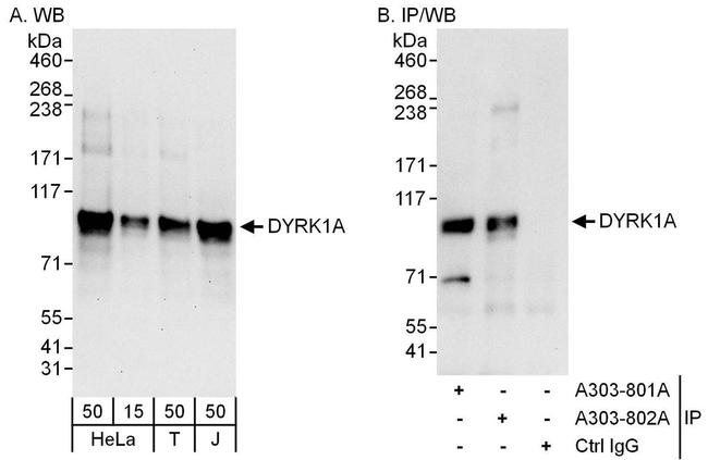 DYRK1A Antibody in Western Blot (WB)