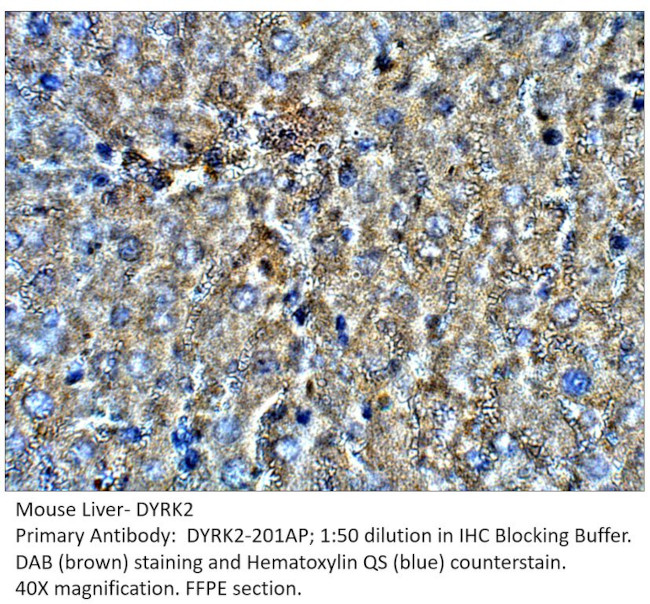 DYRK2 Antibody in Immunohistochemistry (IHC)