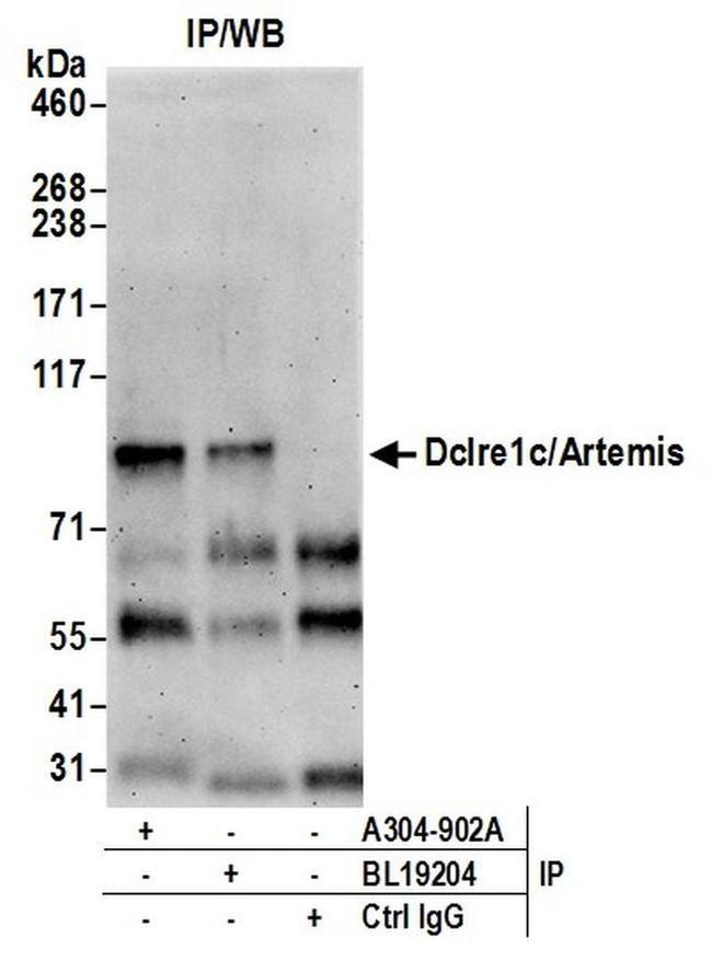 Dclre1c/Artemis Antibody in Western Blot (WB)