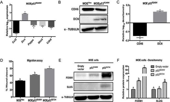 Decorin Antibody in Western Blot (WB)