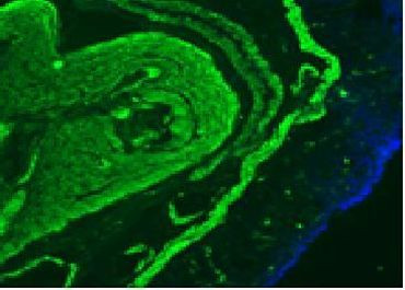 Desmin Antibody in Immunohistochemistry (Frozen) (IHC (F))