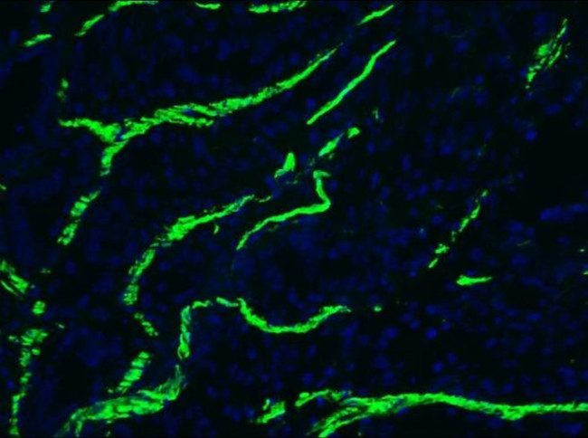 Desmin Antibody in Immunohistochemistry (Frozen) (IHC (F))