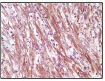 Desmin Antibody in Immunohistochemistry (Paraffin) (IHC (P))