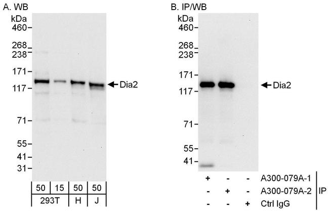 Diaphanous 2 Antibody in Western Blot (WB)