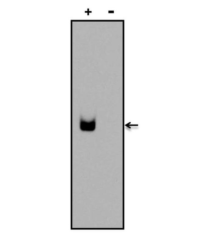 Digoxin Antibody in Western Blot (WB)