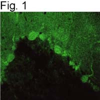 PSD93 Antibody in Immunohistochemistry (IHC)