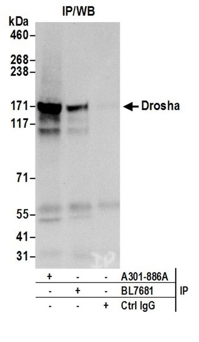 Drosha Antibody in Western Blot (WB)