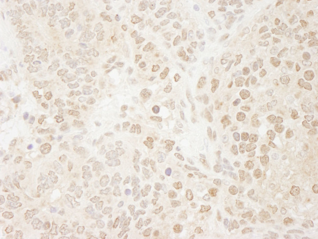 Drosha Antibody in Immunohistochemistry (IHC)