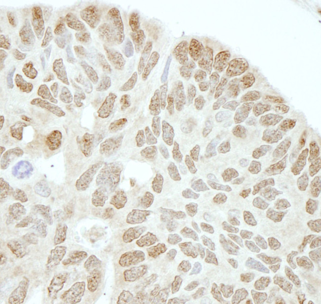 Drosha Antibody in Immunohistochemistry (IHC)