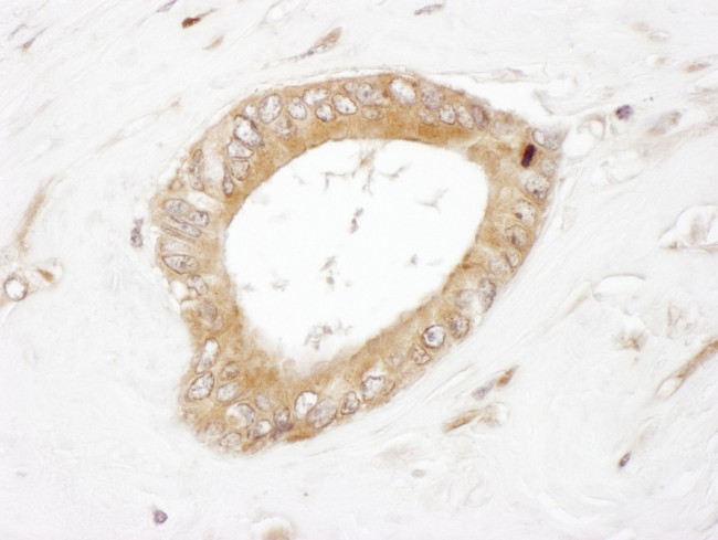 Dynamin 2 Antibody in Immunohistochemistry (IHC)