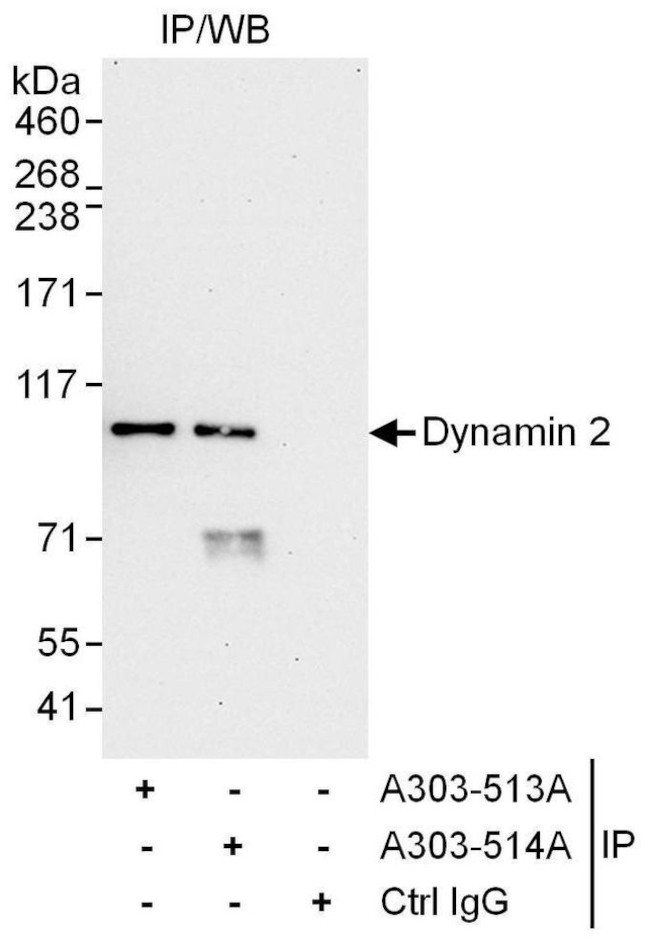 Dynamin 2 Antibody in Immunoprecipitation (IP)