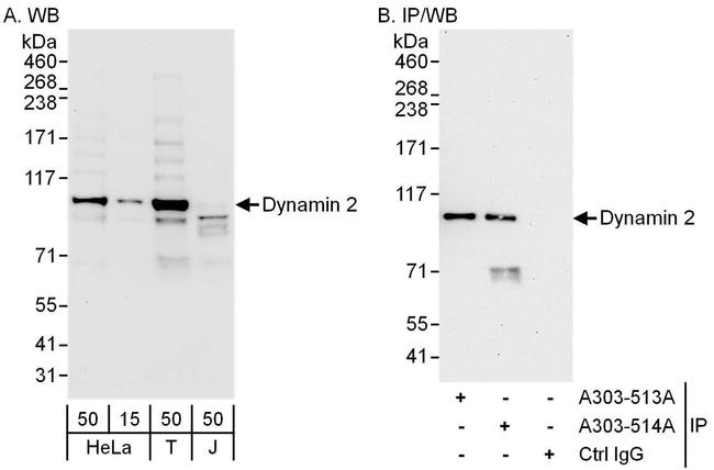 Dynamin 2 Antibody in Western Blot (WB)