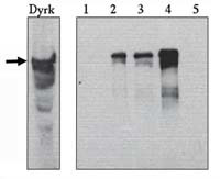 DYRK1A Antibody in Western Blot (WB)