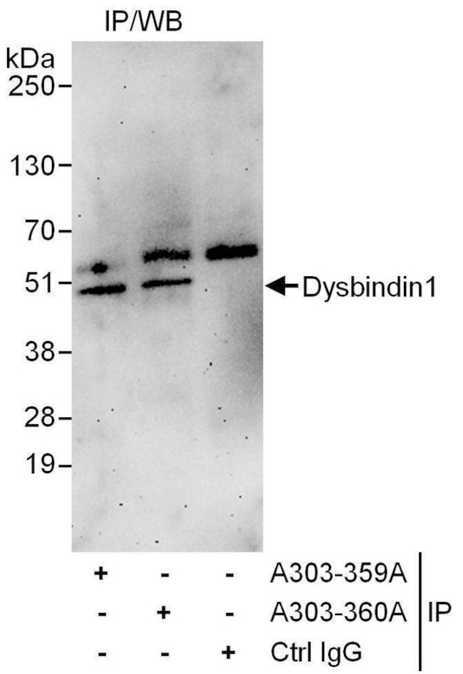 Dysbindin1 Antibody in Immunoprecipitation (IP)