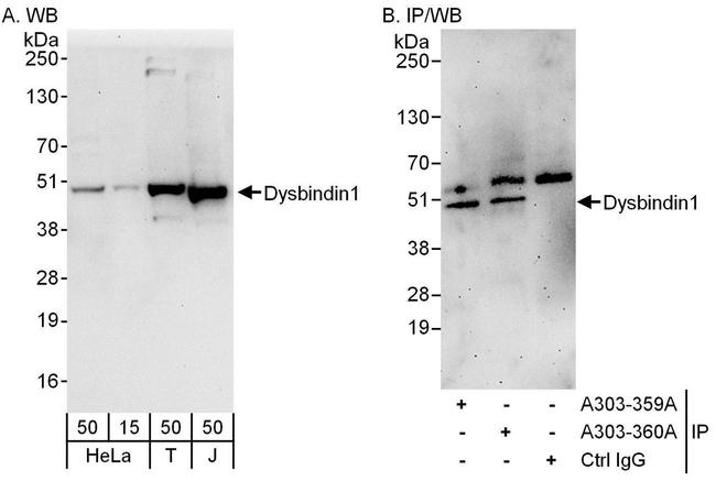 Dysbindin1 Antibody in Western Blot (WB)