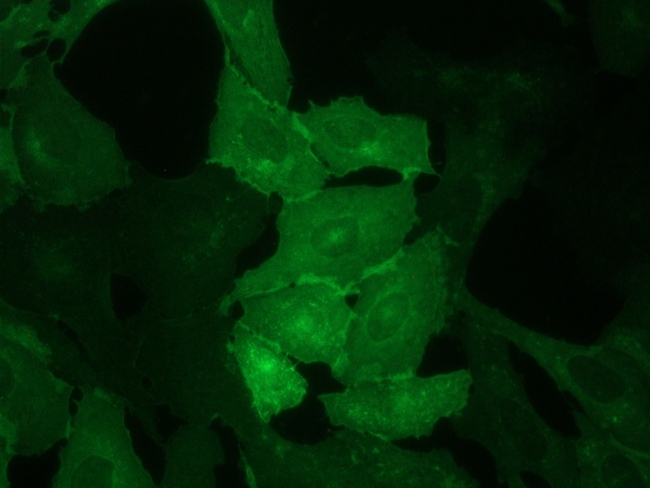 E-selectin Antibody in Immunocytochemistry (ICC/IF)