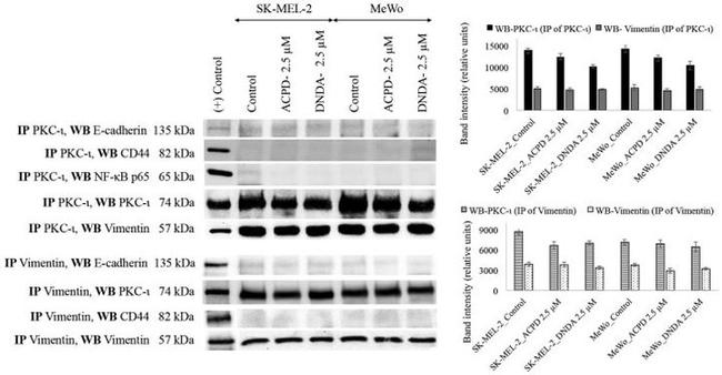 E-cadherin Antibody in Western Blot (WB)