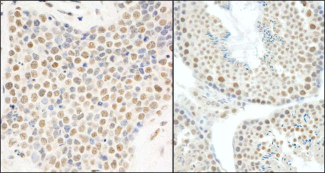 E1B-AP5 Antibody in Immunohistochemistry (IHC)